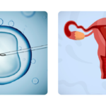 Como fazer cirurgia bariátrica custeada pelo SUS? Veja passo a passo